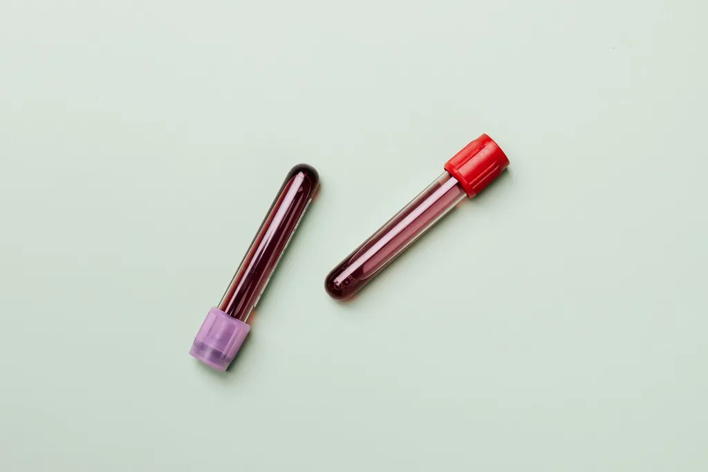Two blood sample tubes on a pale green surface