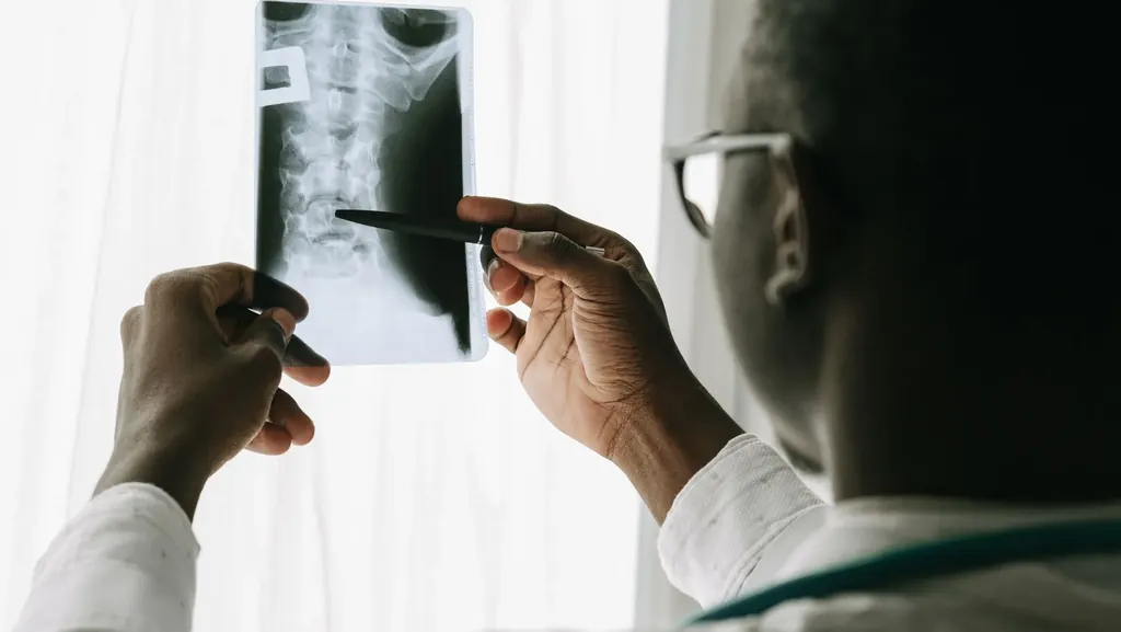 Physician holding up a spine X-ray and pointing to a vertebra with a pen