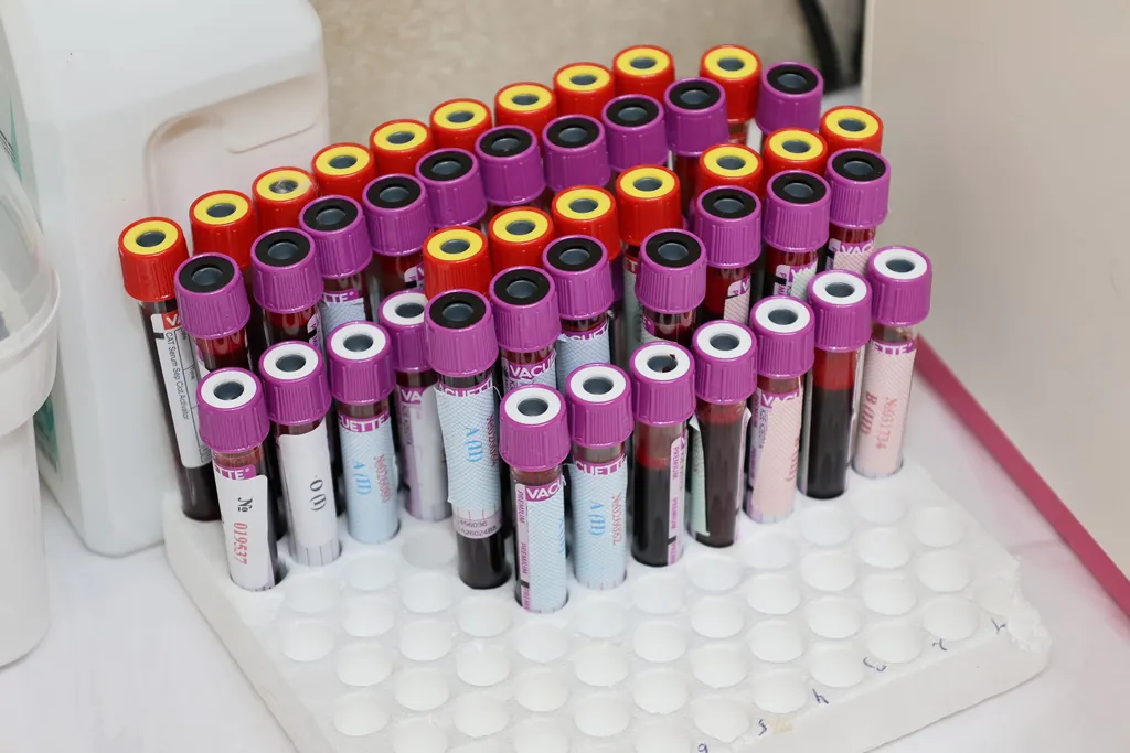Rack of blood sample vials with colored caps in a laboratory