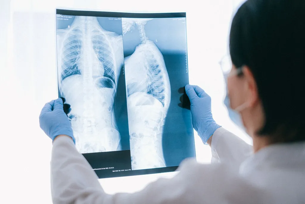 Doctor in gloves holding up a chest X-ray
