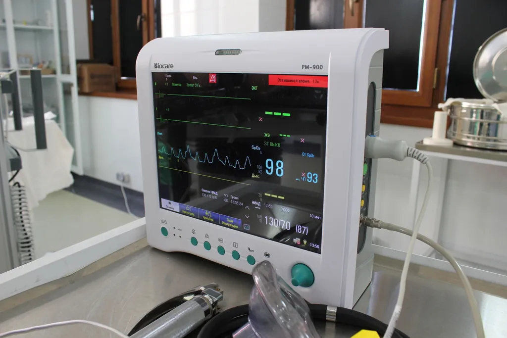 Patient monitor showing vital signs on a hospital stand