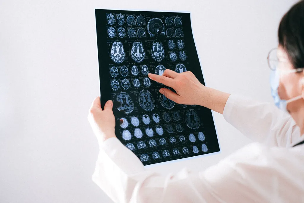 Clinician pointing to a sheet of brain MRI images