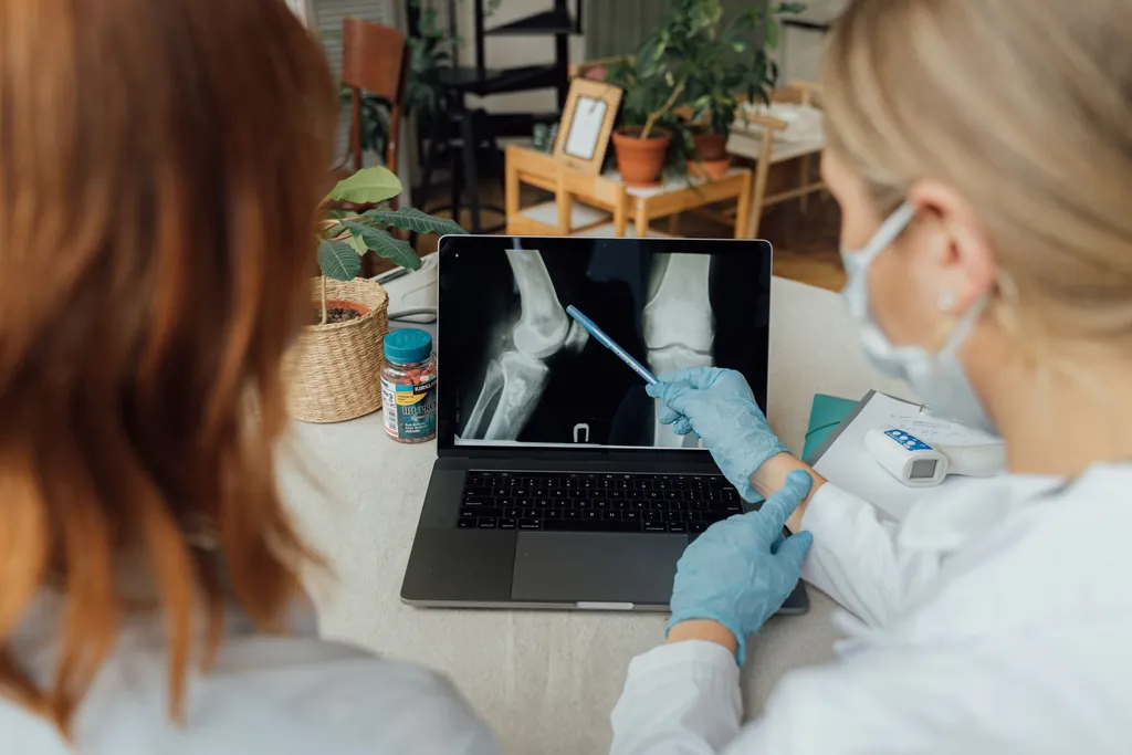 Clinicians reviewing an X-ray of a hand on a laptop